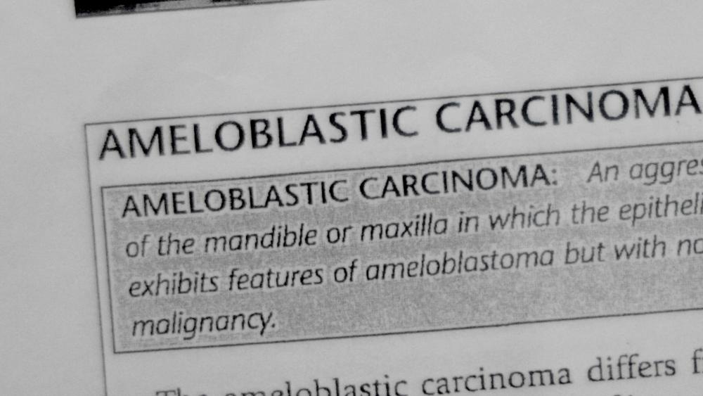 9J64mGV.thumb.jpg.f0c9f191b0f8037afaa457