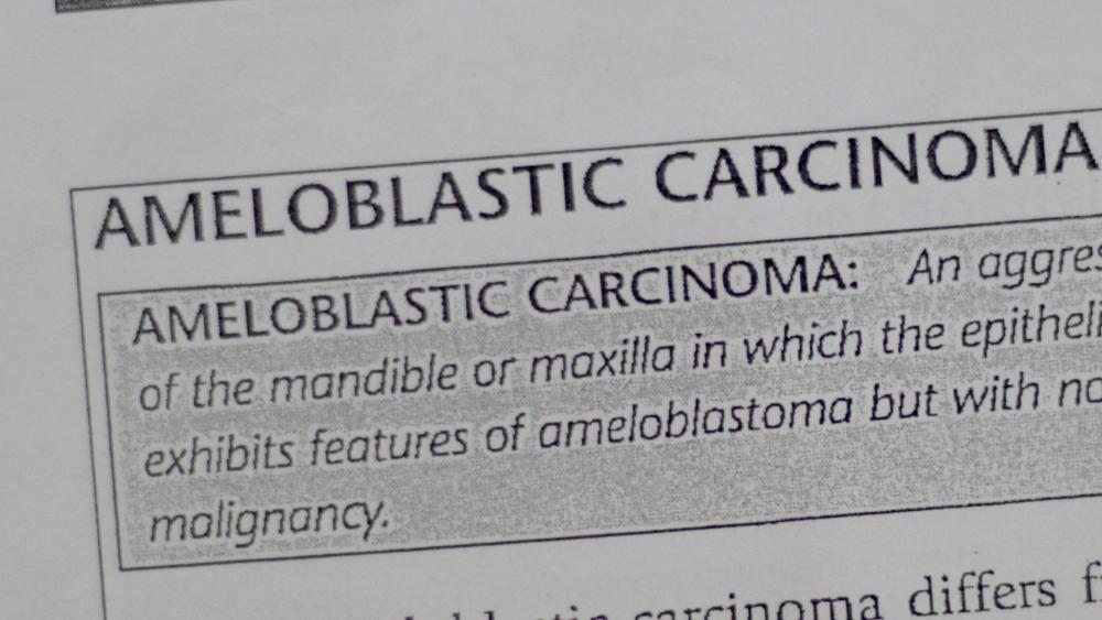 vdVlEwk.thumb.jpg.fa0cb063ba19eeeca469ac