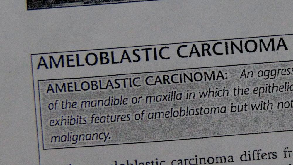 xIHGSbL.thumb.jpg.1a82648c191df39bcbee65