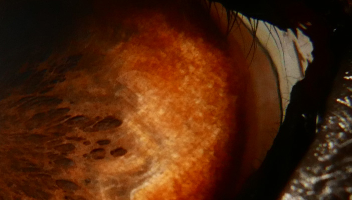 1:1 crop of the approx. 4K JPEG still (would look even better in raw, but support from Adobe STILL isn't out)